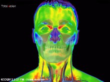 infrarood-medische-thermografie-hoofd