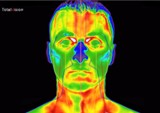 infrarood-medische-thermografie-hoofd