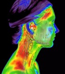 infrarood-medische-thermografie-hoofd-rechts