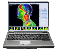 infrarood-medische-thermografie-software